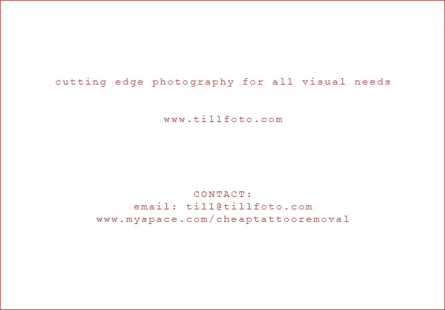 cheap tattoo removal, tattooectomy At discount prices, Till Krautkramer, Till krautkraemer, Till Krautkr&auml;mer, www.tillfoto.com